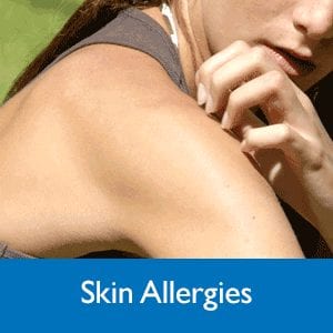 Skin allergies